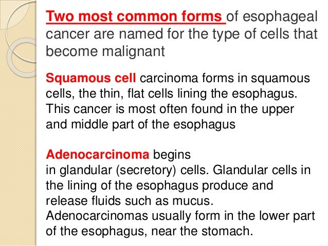 Esophagus cance...