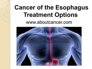 Cancer of the Esophagus 
Treatment Options 
www.aboutcancer.com 
 