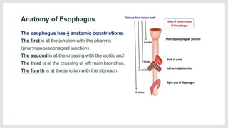 Anatomy of Esophagus
The esophagus has 4 anatomic constrictions.
The first is at the junction with the pharynx
(pharyngeoe...