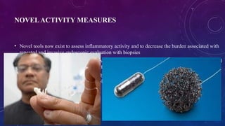 String Ecp Test esosinophilic esophagitis,clinical features,managmentpptx | PPTX