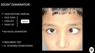 ESOTROPIA Case discussion in detail for pg | PPTX