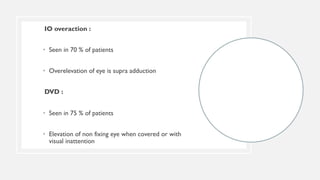 IO overaction :
• Seen in 70 % of patients
• Overelevation of eye is supra adduction
DVD :
• Seen in 75 % of patients
• Elevation of non fixing eye when covered or with
visual inattention
 