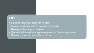 DD :
• Bilateral congenital sixth nerve palsy
• Sensory esotropia due to organic eye disease
• Nystagmus blockage syndrome
• Mechanical limitation of eye movements – Duanes syndrome ,
Mobius syndrome or strabismus fixus
 