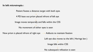 In left microtropia :
Patient fixates a distance target with both eyes
4 PD base out prism placed infront of left eye
Image moves temporally and falls within the CSS
No movement of either eyes is seen
Now prism is placed infront of right eye Adducts to maintain fixation
Left eye also moves to the left ( Herings law )
Image falls within CSS
No subsequent refixation is seen
 