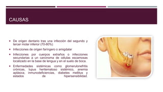 CAUSAS
 De origen dentario tras una infección del segundo y
tercer molar inferior (70-80%)
 Infecciones de origen faríngero o amigdalar
 Infecciones por cuerpos extraños o infecciones
secundarias a un carcinoma de células escamosas
localizado en la base de lengua y en el suelo de boca.
 Enfermedades sistémicas como glomerulonefritis
crónicas, lupus heritematoso sistémico, anemia
aplásica, inmunodeficiencias, diabetes mellitus y
estados de hipersensibilidad.
 