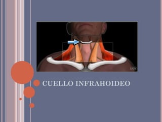 CUELLO INFRAHOIDEO
 