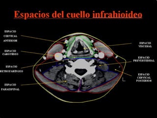 Espacios del cuello