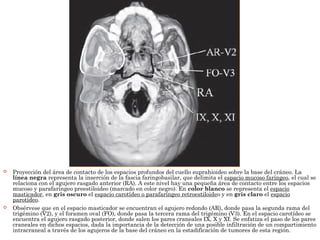  Proyección del área de contacto de los espacios profundos del cuello suprahioideo sobre la base del cráneo. La
línea negra representa la inserción de la fascia faringobasilar, que delimita el espacio mucoso faríngeo, el cual se
relaciona con el agujero rasgado anterior (RA). A este nivel hay una pequeña área de contacto entre los espacios
mucoso y parafaríngeo preestiloideo (marcado en color negro). En color blanco se representa el espacio
masticador, en gris oscuro el espacio carotídeo o parafaríngeo retroestiloideo y en gris claro el espacio
parotídeo.
 Obsérvese que en el espacio masticador se encuentran el agujero redondo (AR), donde pasa la segunda rama del
trigémino (V2), y el foramen oval (FO), donde pasa la tercera rama del trigémino (V3). En el espacio carotídeo se
encuentra el agujero rasgado posterior, donde salen los pares craneales IX, X y XI. Se enfatiza el paso de los pares
craneales en dichos espacios, dada la importancia de la detección de una posible infiltración de un compartimiento
intracraneal a través de los agujeros de la base del cráneo en la estadificación de tumores de esta región.
 