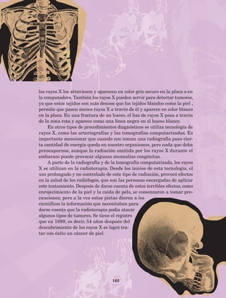 165
los rayos X los atraviesen y aparecen en color gris oscuro en la placa o en
la computadora. También los rayos X pueden servir para detectar tumores,
ya que estos tejidos son más densos que los tejidos blandos como la piel ,
permite que pasen menos rayos X a través de él y aparece en color blanco
en la placa. En una fractura de un hueso, el haz de rayos X pasa a través
de la zona rota y aparece como una línea negra en el hueso blanco.
En otros tipos de procedimientos diagnósticos se utiliza tecnología de
rayos X, como las arteriografías y las tomografías computarizadas. Es
importante mencionar que cuando nos toman una radiografía pues cier-
ta cantidad de energía queda en nuestro organismos, pero nada que deba
preocuparnos, aunque la radiación emitida por los rayos X durante el
embarazo puede provocar algunas anomalías congénitas.
A parte de la radiografía y de la tomografía computarizada, los rayos
X se utilizan en la radioterapia. Desde los inicios de esta tecnología, el
uso prolongado y no controlado de este tipo de radiación, provocó efectos
en la salud de los radiólogos, que son las personas encargadas de aplicar
este tratamiento. Después de darse cuenta de estos terribles efectos, como
enrojecimiento de la piel y la caída de pelo, se comenzaron a tomar pre-
cauciones; pero a la vez estas pistas dieron a los
científicos la información que necesitaban para
darse cuenta que la radioterapia podía atacar
algunos tipos de tumores. Se tiene el registro
que en 1899, es decir, 54 años después del
descubrimiento de los rayos X se logró tra-
tar con éxito un cáncer de piel.
AB-Lecturas-5 NO BERMAN p001-208.indd 165 27/03/12 13:30
 