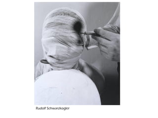 Rudolf Schwarzkogler
 