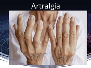 Artralgia
 