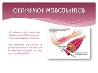 Un calambre es la contracción
involuntaria y dolorosa de un
músculo o un grupo muscular.
Los calambres musculares se
presentan cuando un músculo
se tensiona (contrae) sin que
uno trate de hacerlo.
 
