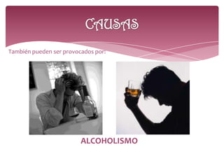 También pueden ser provocados por:
ALCOHOLISMO
 