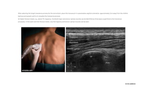 ESP block | PDF