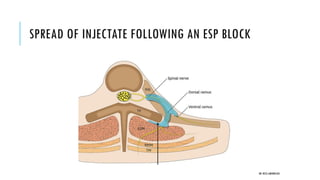 ESP block | PDF