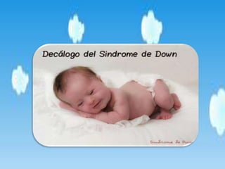 Prader Willi y Sindrome de Down