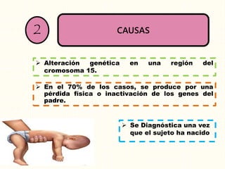 CAUSAS2
 Alteración genética en una región del
cromosoma 15.
 En el 70% de los casos, se produce por una
pérdida física o inactivación de los genes del
padre.
 Se Diagnóstica una vez
que el sujeto ha nacido
 