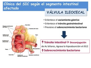 Clínica del SIC según el segmento intestinal
afectado
VÁLVULA ILEOCECAL
• Enlentece el vaciamiento gástrico
• Enlentece el tránsito gastrointestinal
• Previene el sobrecrecimiento bacteriano
Tránsito intestinal Desconjugación
de Ac biliares, Agrava la hipoabsorción vit B12
Sobrecrecimiento bacteriano
 