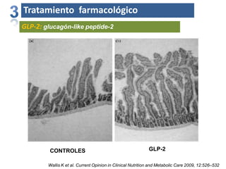 Tratamiento farmacológico
GLP-2: glucagón-like peptide-2
CONTROLES GLP-2
Wallis K et al. Current Opinion in Clinical Nutrition and Metabolic Care 2009, 12:526–532
 
