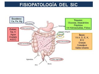 FISIOPATOLOGÍA DEL SIC
 