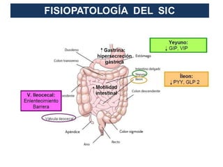 FISIOPATOLOGÍA DEL SIC
 