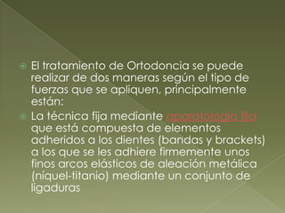 El tratamiento de Ortodoncia se puede realizar de dos maneras según el tipo de fuerzas que se apliquen, principalmente están:La técnica fija mediante aparatología fija que está compuesta de elementos adheridos a los dientes (bandas y brackets) a los que se les adhiere firmemente unos finos arcos elásticos de aleación metálica (níquel-titanio) mediante un conjunto de ligaduras