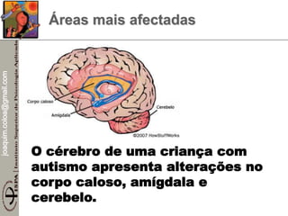 joaquim.coloa@gmail.com
O cérebro de uma criança com
autismo apresenta alterações no
corpo caloso, amígdala e
cerebelo.
Áreas mais afectadas
 