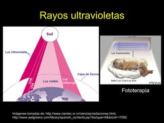 Rayos ultravioletas




                                                                       Fototerapia



Imágenes tomadas de: http://www.cientec.or.cr/ciencias/radiaciones.html,
http://www.walgreens.com/library/spanish_contents.jsp?doctype=6&docid=17092
 