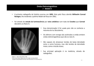 Ondas Eletromagnéticas
 RAIOS X
• A primeira radiografia da história ocorreu em 1895, feita pelo físico alemão Wilheelm Conrad
Rontgen, lhe rendendo o prêmio Nobel de física em 1901;
Vídeo 9 – Raio X de punho e mão
Fonte: http://www.megacurioso.com.br/gifs-animados/45269
-veja-gifs-surpreendentes-de-raios-x-de-articulacoes-em-movimento.htm
• Foi através do estudo da luminescência por raios catódicos num tubo de Crookes que Conrad
descobriu os Raios X;
• Essa denominação X foi usada pois não se conhecia a
natureza da luz descoberta;
• São capazes de atravessar tecidos de baixa densidade
como a carne humana, mas não tecidos de densidade
maior, como o tecido ósseo;
• Os elétrons com energia são acelerados e então emitem
ondas eletromagnéticas que são os raios X;
• Sua principal aplicação é na medicina, através de
radiografias.
22
 