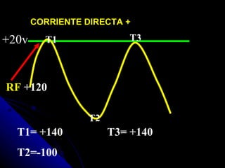 CORRIENTE DIRECTA +

+20v     T1               T3




RF +120

                  T2
  T1= +140             T3= +140
  T2=-100
 