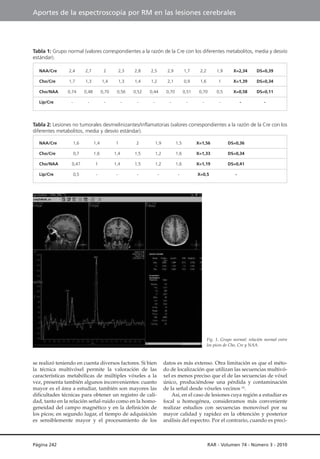 Aportes de la espectroscopía por RM en las lesiones cerebrales

Tabla 1: Grupo normal (valores correspondientes a la razón...