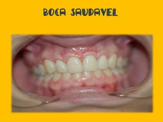 BOCA SAUDAVEL
 