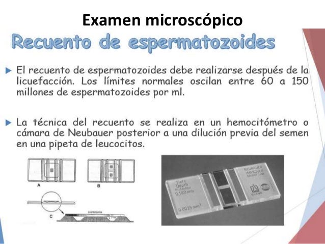 Espermatobioscopia
