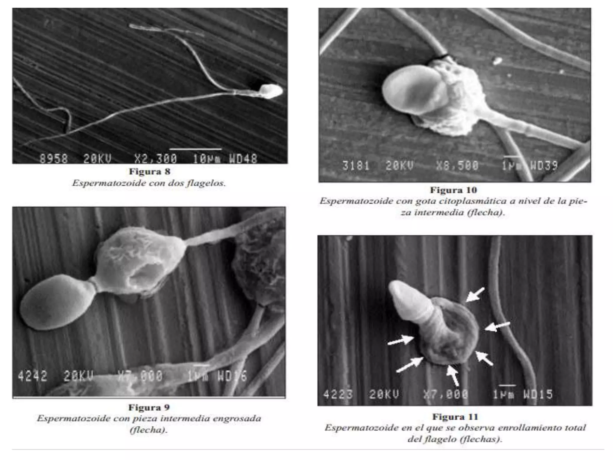 Espermatobioscopia: Analisis funcional del semen | PPT