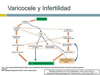 Varicocele y Infertilidad 
Nikolaos Sofikitis et al, (2014) Mysteries, Facts, and Fiction in 
Varicocele Pathophysiology and Treatment Eur. Urol Suppl. 682;1-11 
 