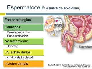 Espermatocele (Quiste de epididimo) 
Factor etiologico 
Hallazgos: 
• Masa indolora, lisa 
• Transiluminación 
No tratamiento 
• Doloroso 
US si hay dudas 
• ¿Hidrocele loculado? 
Incision simple Stephen M. (2010). Common Scrotal and Testicular Problems. 
Prim Care Clin Office Pract 37; 618–619 
 