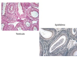 Epidídimo
Testículo
 