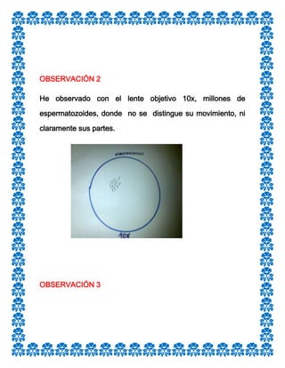 OBSERVACIÓN 2
He observado con el lente objetivo 10x, millones de
espermatozoides, donde no se distingue su movimiento, ni
claramente sus partes.

OBSERVACIÓN 3

 