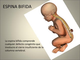 La espina bífida comprende 
cualquier defecto congénito que 
involucre el cierre insuficiente de la 
columna vertebral. 
 