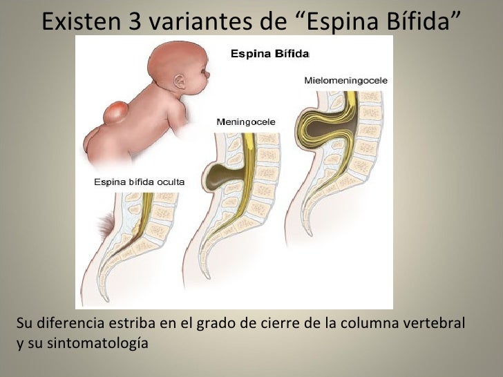 El grano con la cabeza blanca sobre la persona al mamón