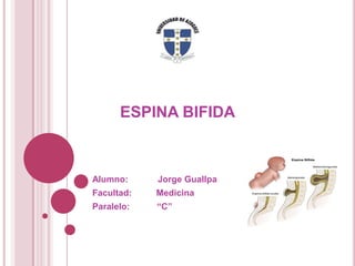ESPINA BIFIDA

Alumno:

Jorge Guallpa

Facultad:

Medicina

Paralelo:

“C”

 