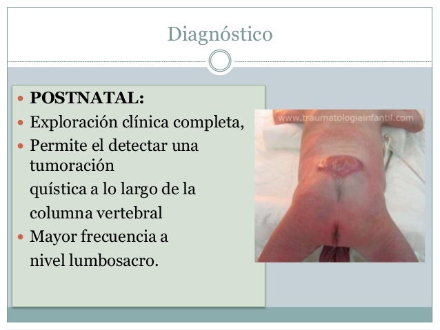 Ha caído a la espalda duele el pie