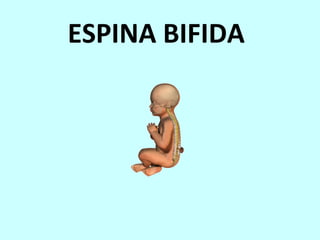 ESPINA BIFIDA 