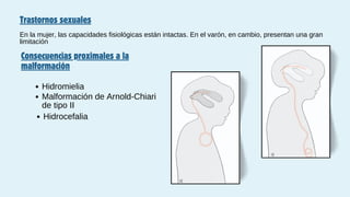 Consecuencias proximales a la
malformación
Trastornos sexuales
En la mujer, las capacidades fisiológicas están intactas. En el varón, en cambio, presentan una gran
limitación
Hidromielia
Malformación de Arnold-Chiari
de tipo II
Hidrocefalia
 