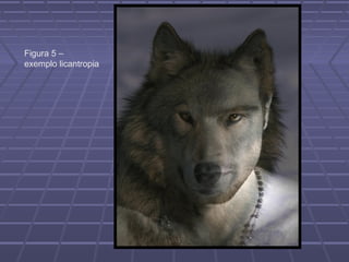 Figura 5 –
exemplo licantropia
 