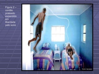 Figura 2 –
cordão
prateado
expandido
em
liberdade
pelo sono
 