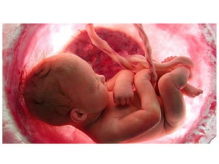 “Cap.: Seria o embrião um mero 'amon-
toado de células'?
Moore e Persaud (2000, p. 2), ilustres embri-
ologistas, afirmam que o zigoto e o embrião
inicial são organismos humanos vivos, nos
quais já estão fixadas todas as bases do in-
divíduo adulto. Sendo assim, não é possível
interromper algum ponto do continuum – zi-
goto, feto, criança, adulto, velho – sem cau-
sar danos irreversíveis ao bem maior, que é
a própria vida.
==>
Zigoto: célula resultante da união do gameta masculino ao
feminino, em estágio anterior ao da divisão celular. (HOUAISS)
 