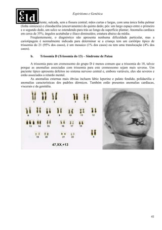Espiritismo e Genética

usualmente saliente, sulcada, sem a fissura central; mãos curtas e largas, com uma única linha palmar
(linha simiesca) e clinodactilia (encurvamento) do quinto dedo; pés: um largo espaço entre o primeiro
e o segundo dedo, um sulco se estendendo para trás ao longo da superfície plantar; Anomalia cardíaca
em cerca de 35%; ângulos acetabular e ilíaco diminuídos; estatura abaixo da média.
        Freqüentemente, o diagnóstico não apresenta nenhuma dificuldade particular, mas a
cariotipagem é normalmente indicada para determinar se a criança tem um cariótipo típico de
trissomia do 21 (95% dos casos), é um mosaico (1% dos casos) ou tem uma translocação (4% dos
casos).

       b.     Trissomia D (Trissomia do 13) – Síndrome de Patau

        A trissomia para um cromossomo do grupo D é menos comum que a trissomia do 18, talvez
porque as anomalias associadas com trissomia para este cromossomo sejam mais severas. Um
paciente típico apresenta defeitos no sistema nervoso central e, embora variáveis, eles são severos e
estão associados a retardo mental.
        As anomalias externas mais óbvias incluem lábio leporino e palato fendido, polidactilia e
anomalias características dos padrões dérmicos. Também estão presentes anomalias cardíacas,
viscerais e da genitália.




                                                                                                  41
 