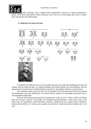 Espiritismo e Genética

malformadas; mãos: fechadas, com o segundo dedo superpondo o terceiro e o quinto superpondo o
quarto, uma única linha palmar (linha simiesca), arcos em seis ou mais dedos; pés tortos; coração:
tipo característico de malformação.


        d. Síndrome do Choro do Gato




       É chamado de Síndrome do cri du chat (choro do gato), por causa da semelhança do choro da
criança com um miado de gato. As crianças afetadas têm retardo mental, são microcefálicas, têm um
aspecto facial característico com hipertelorismo marcante e têm padrões dérmicos característicos.
       Essa síndrome pode ocorrer na prole de um portador de translocação que formou um gameta
não balanceado com uma deficiência. Na mesma família, podem ser encontrados pacientes com a
correspondente duplicação.
       Pode ser uma monossomia parcial do cromossomo 5 (5p-) ou do nº 4 (4p-), sendo este último
mais raro do que o anterior. Esta produz um fenótipo anormal diferente e muito mais severo, com
baixo peso de nascimento, desenvolvimento anormal, coloboma da íris, aspecto facial anormal e
muitos outros defeitos. As crianças do segundo caso não têm o miado de gato da síndrome do cri du
chat.




                                                                                               43
 