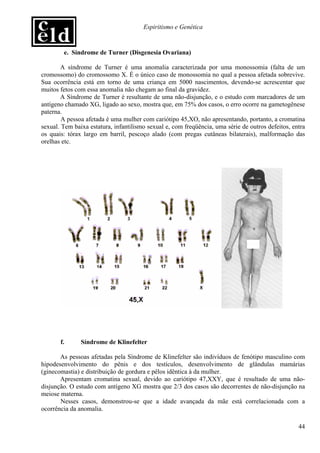 Espiritismo e Genética


        e. Síndrome de Turner (Disgenesia Ovariana)

       A síndrome de Turner é uma anomalia caracterizada por uma monossomia (falta de um
cromossomo) do cromossomo X. É o único caso de monossomia no qual a pessoa afetada sobrevive.
Sua ocorrência está em torno de uma criança em 5000 nascimentos, devendo-se acrescentar que
muitos fetos com essa anomalia não chegam ao final da gravidez.
       A Síndrome de Turner é resultante de uma não-disjunção, e o estudo com marcadores de um
antígeno chamado XG, ligado ao sexo, mostra que, em 75% dos casos, o erro ocorre na gametogênese
paterna.
        A pessoa afetada é uma mulher com cariótipo 45,XO, não apresentando, portanto, a cromatina
sexual. Tem baixa estatura, infantilismo sexual e, com freqüência, uma série de outros defeitos, entra
os quais: tórax largo em barril, pescoço alado (com pregas cutâneas bilaterais), malformação das
orelhas etc.




       f.      Síndrome de Klinefelter

       As pessoas afetadas pela Síndrome de Klinefelter são indivíduos de fenótipo masculino com
hipodesenvolvimento do pênis e dos testículos, desenvolvimento de glândulas mamárias
(ginecomastia) e distribuição de gordura e pêlos idêntica à da mulher.
       Apresentam cromatina sexual, devido ao cariótipo 47,XXY, que é resultado de uma não-
disjunção. O estudo com antígeno XG mostra que 2/3 dos casos são decorrentes de não-disjunção na
meiose materna.
       Nesses casos, demonstrou-se que a idade avançada da mãe está correlacionada com a
ocorrência da anomalia.

                                                                                                   44
 